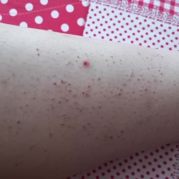 Duru Tıp Merkezi Dikkatsiz Ve Özensiz İşlemler