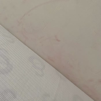 Taç Renk Atma Ve Her Yere Bulaşma Problemi