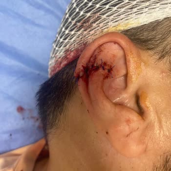 Kamil Koç Eşimin Kulağına Atılan 12 Dikişin Hesabını Kim Verecek Bize?