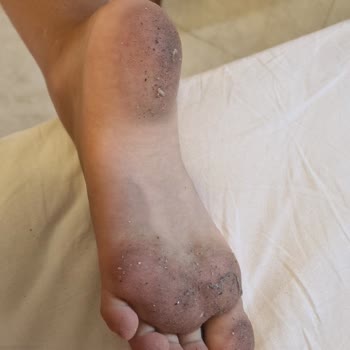 Club Resort Atlantis Otelden Resmen Kaçtık