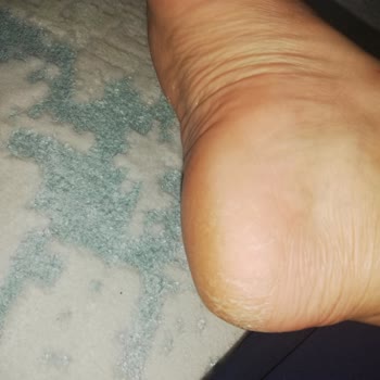 Watsons İşlevini Görmediğim Ayak Maskesi Mjcare!