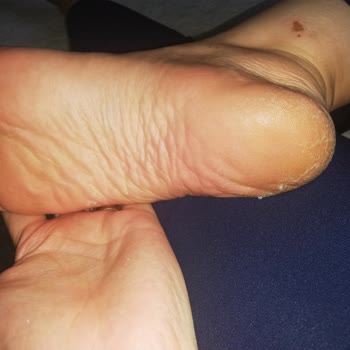 Watsons İşlevini Görmediğim Ayak Maskesi Mjcare!