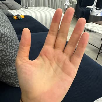 Sleepy Avuç İçlerimi Alerji Yaptı.