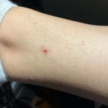 Gillette Bıçağın Ayağımı Kesmesi