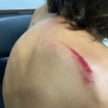 Mervehan Residence Otelin Pis ve Kötü Oluşu