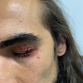 Mervehan Residence Otelin Pis ve Kötü Oluşu