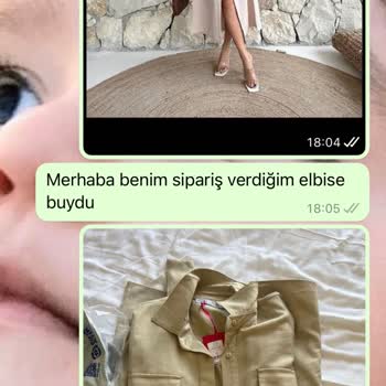 By Sadem Elbise İadesiyle İlgili Sorun