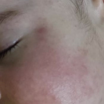 Bioderma Bizi Hastane Hastane Dolaştırdı