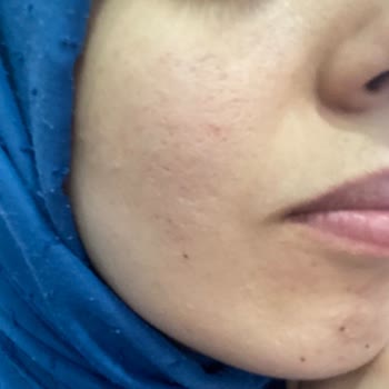 Estetika Güzellik Salonu Cilt Bakımı İlgisizlik