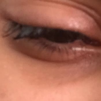 Bee Beauty Makyaj Temizleyici Gözümü Mahvetti