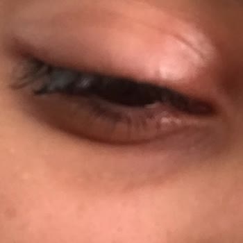 Bee Beauty Makyaj Temizleyici Gözümü Mahvetti