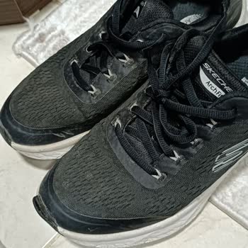 Skechers Ayakkabının Burnu Acildi