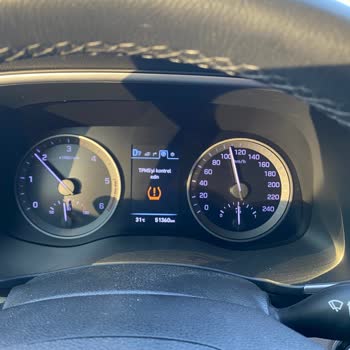 Hyundai Garantisi Devam Eden Aracın Sorununu Çözmüyor.