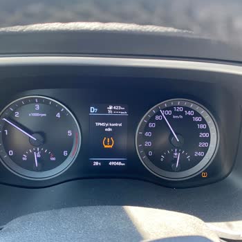 Hyundai Garantisi Devam Eden Aracın Sorununu Çözmüyor.