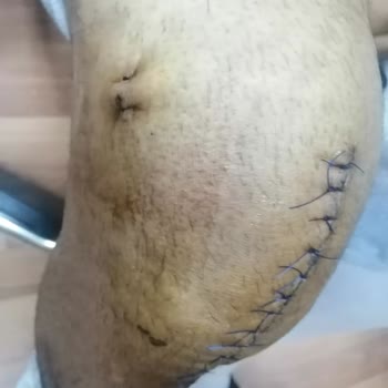 Sincan 13 No. Lu Aile Sağlığı Merkezi Sincan Tandoğan Sorumsuz Davranışlar Aile Hekimliği