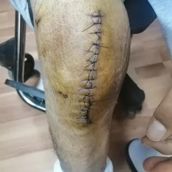Sincan 13 No. Lu Aile Sağlığı Merkezi Sincan Tandoğan Sorumsuz Davranışlar Aile Hekimliği
