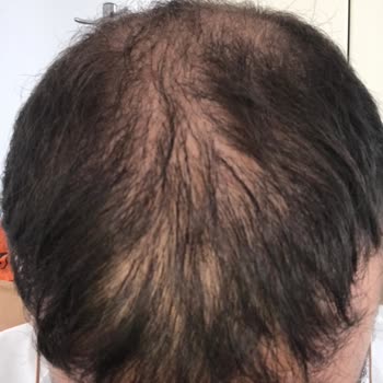 Clinichair (İzmir) Ekim Sonrası İletişim Eksikliği Ve Tavsiye Edilemezlik
