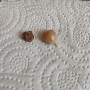 Tada Basmati Pilavın İçinden Büyük Taş Çıktı