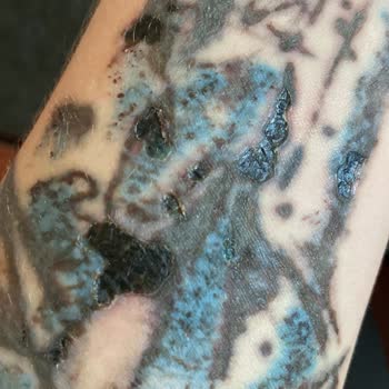 Suit Güzellik Merkezleri Memnuniyetsizliği