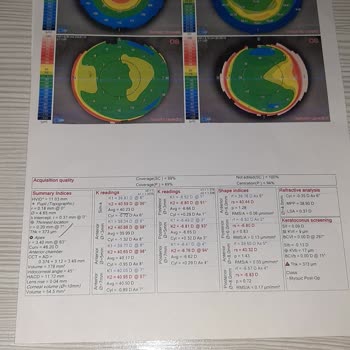 Veni Vidi Göz Sağlık Grubu Pişman Olduğum Ameliyatım