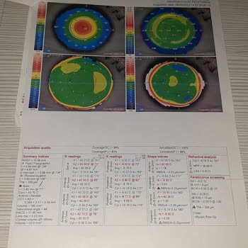 Veni Vidi Göz Sağlık Grubu Pişman Olduğum Ameliyatım