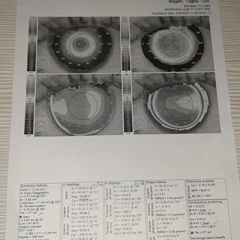 Veni Vidi Göz Sağlık Grubu Pişman Olduğum Ameliyatım