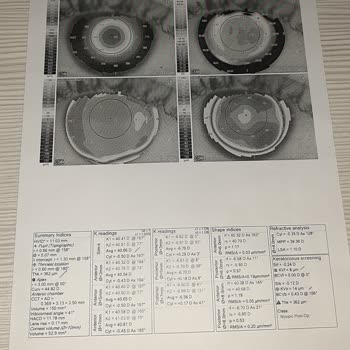 Veni Vidi Göz Sağlık Grubu Pişman Olduğum Ameliyatım