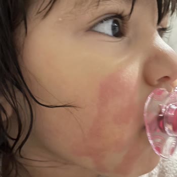 Anadolu Hünkar İçecek ve Gıda Ürün Kötülüğü Alerji Yapması