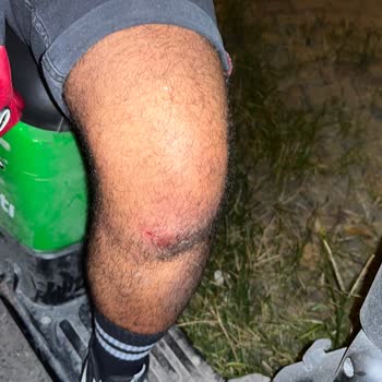 Martı Mobilet Arızası! Ve Talep Aramalarına Bakmıyorlar