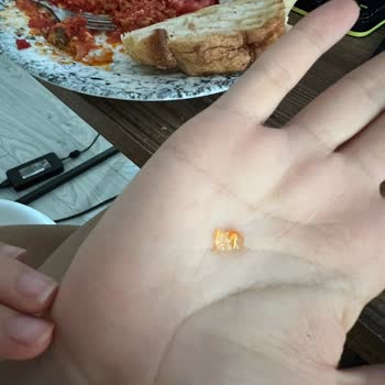 Başak Sandviç (Ankara) Menemenden Çıkan Cam Parçası!