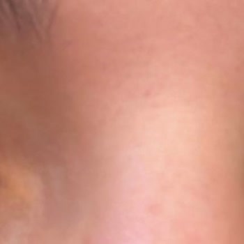 You Estetik Hizmetin Kötülüğü Ve Maddi Zarar