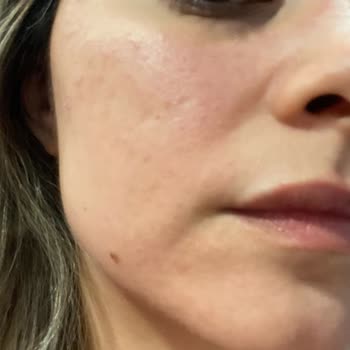 Şulemsi Güzellik Ve Zayıflama Merkezi Şulemsi Cilt Bakımı