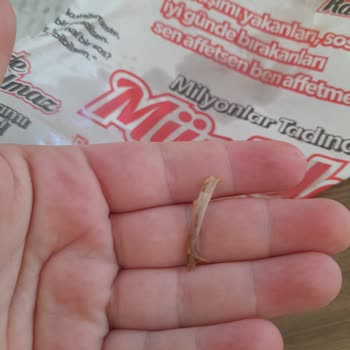 Öncü Döner Dönerden Kemik Çıktı