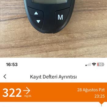 Freestyle Libre Sensörü Hatalı Yüksek Ölçüyor