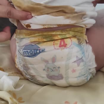 Molfix Bebek Bezinin Sızdırması