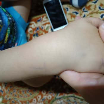 Medical Park Hastanesi Anestezi İşlemi Sırasında Yaşanan Sorunlar