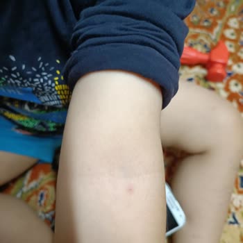 Medical Park Hastanesi Anestezi İşlemi Sırasında Yaşanan Sorunlar