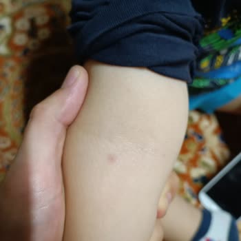 Medical Park Hastanesi Anestezi İşlemi Sırasında Yaşanan Sorunlar