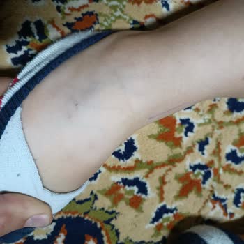 Medical Park Hastanesi Anestezi İşlemi Sırasında Yaşanan Sorunlar