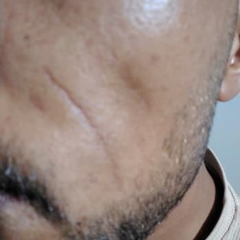 Esmyworld Güzellik Salonundaki İşlemlerden Memnun Kalmadım