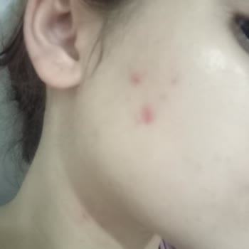 ziaja Sizin Yüzünden Sağlığımdan Oldum