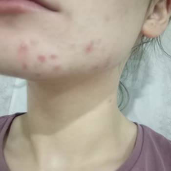ziaja Sizin Yüzünden Sağlığımdan Oldum