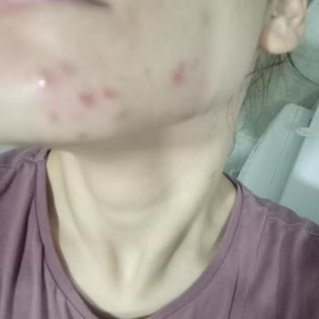 ziaja Sizin Yüzünden Sağlığımdan Oldum
