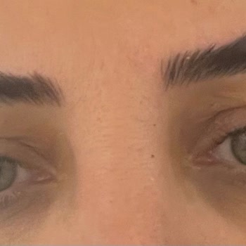 Emsal Doğan Güzellik ve Tırnak Merkezi Kaş-kirpik Laminasyon Felaketi