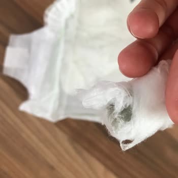 Önlem Çocuk Bezi Bebek Bezinden Çıkan Yabancı Cisimler