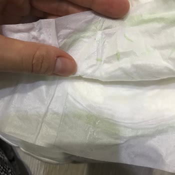Önlem Çocuk Bezi Bebek Bezinden Çıkan Yabancı Cisimler