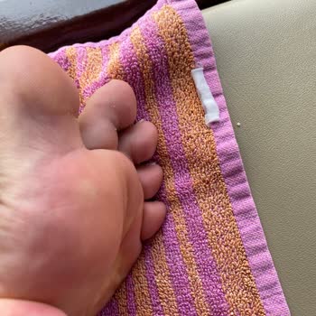 Hummel Taban Keçesinin Yol Açtığı Sorunlar