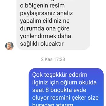 Çiğdem Koç Güzellik Lazer Epilasyon Mağduriyeti...