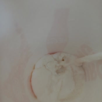 Burger King'den Aldığım Milk Shake'lerde Hijyen Sorunu Var