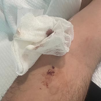 Memorial Hastanesi Hemşirelik Süreci Şikayeti